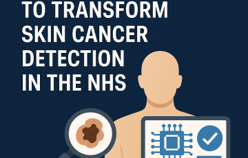 NICE Approves AI Tool to Triage Skin Cancer